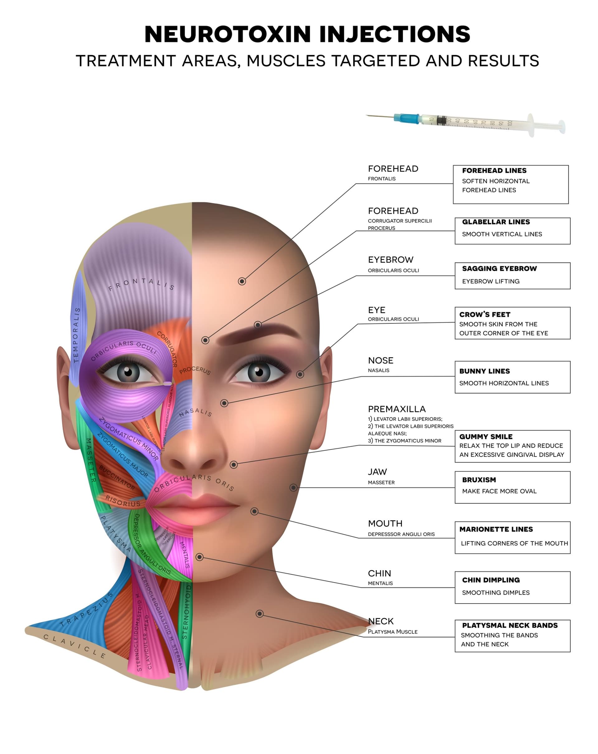 Injection_Botox