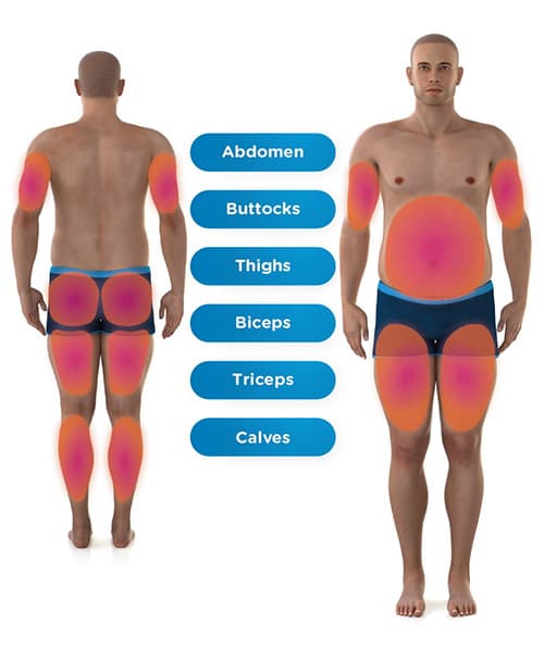 Emsculpt Neo Areas Man