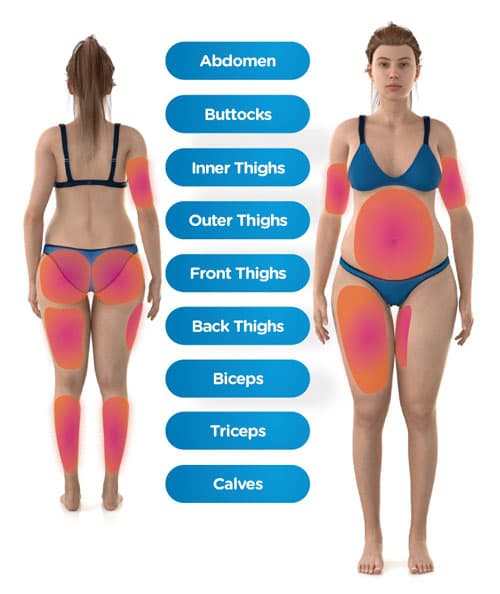 Emsculpt Neo Areas Woman