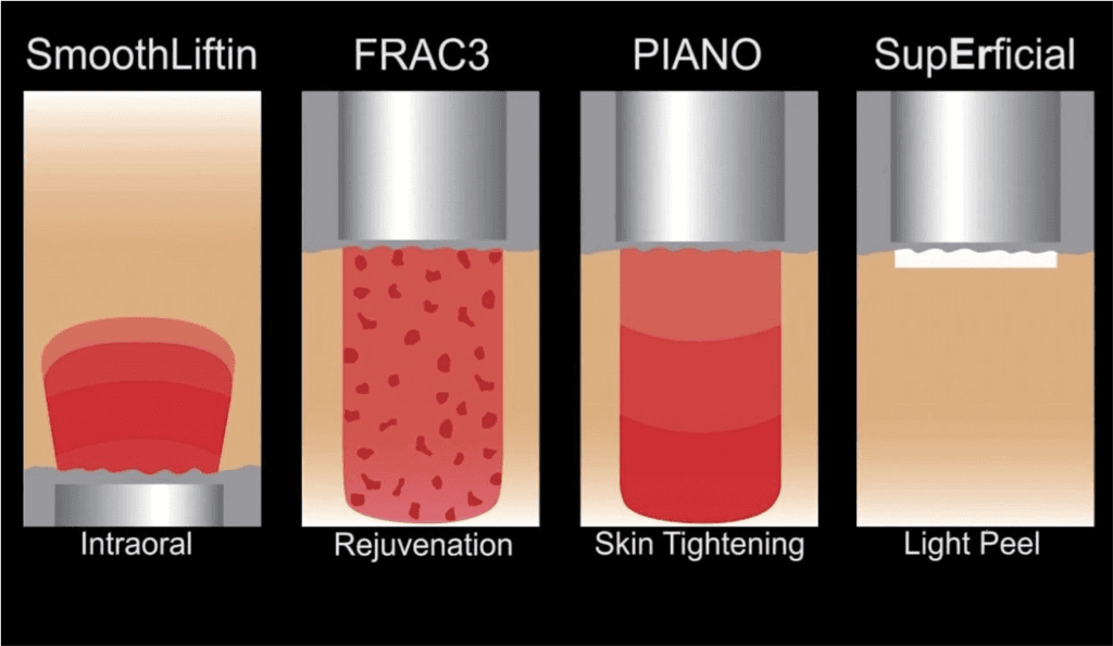 Fotona 4D categories