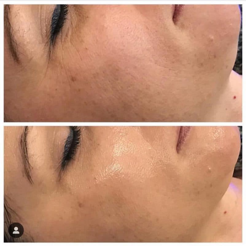 Before and After 1