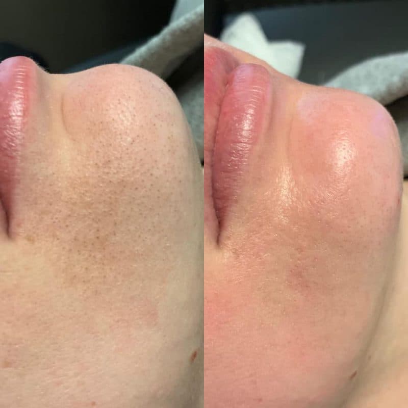 Before and After 2