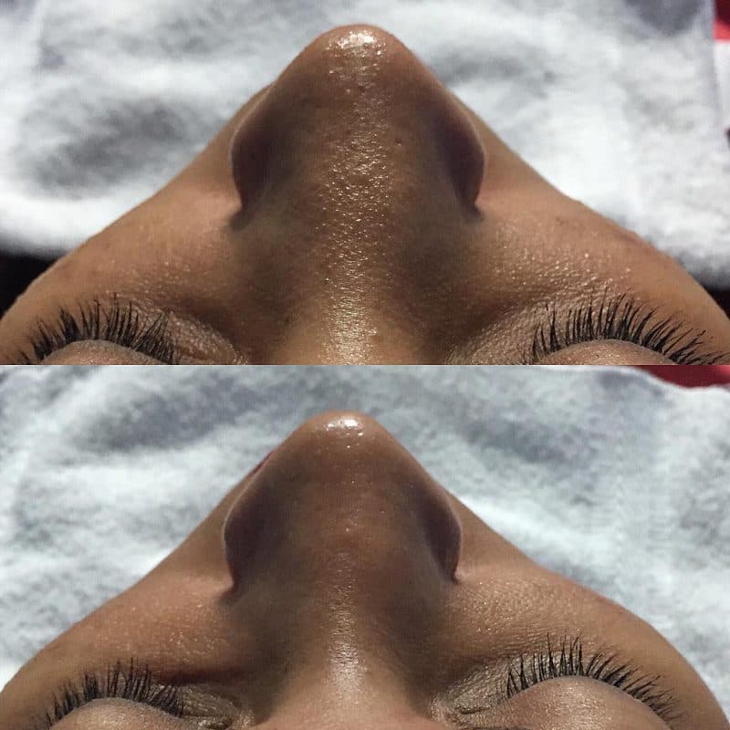 Before and After 3