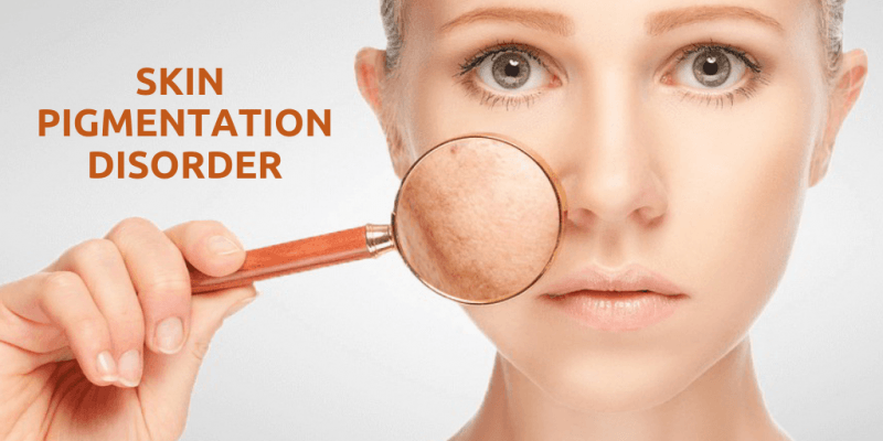 Pigmentation & Brightening