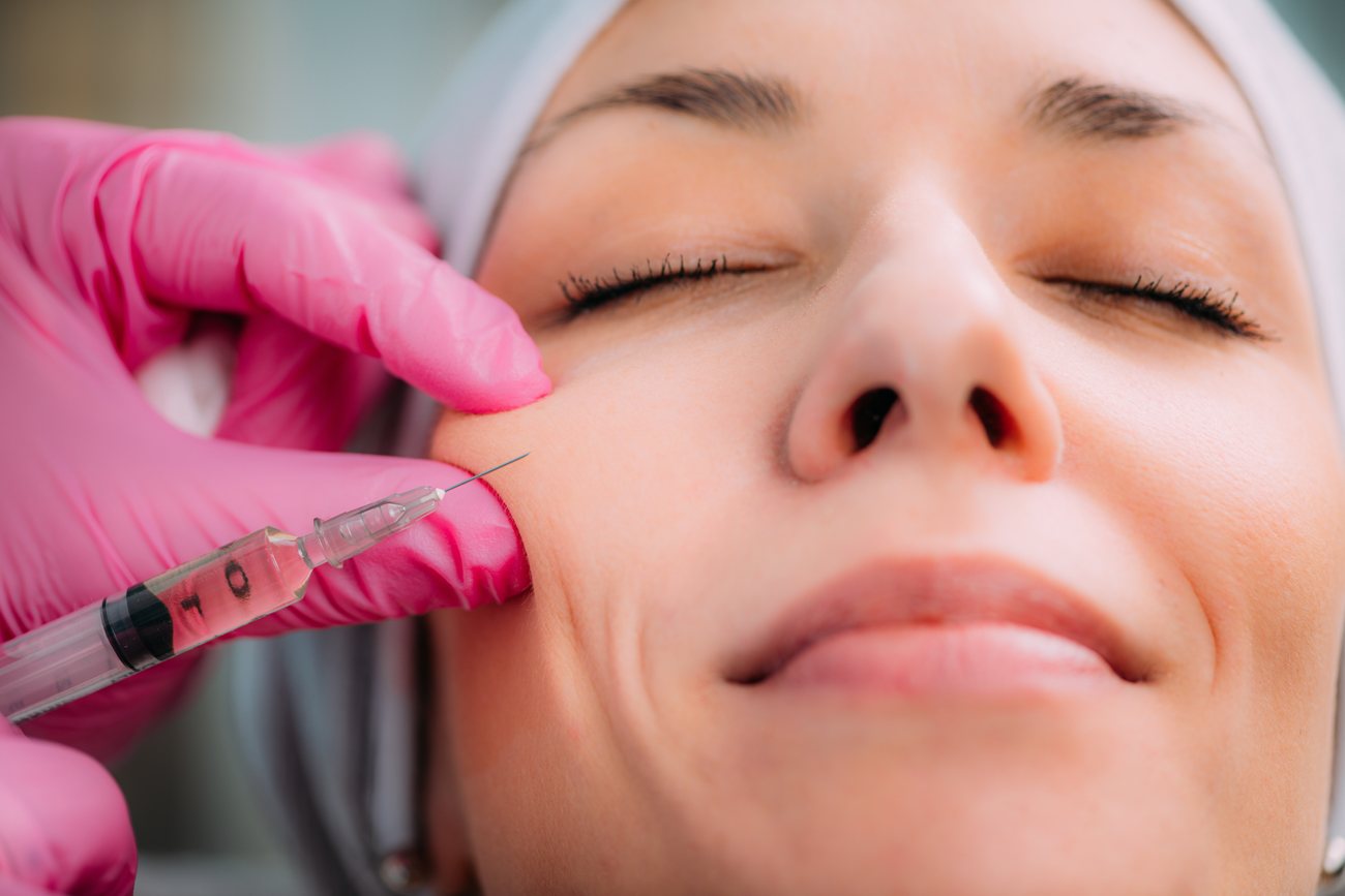 Cheek filler injection at Deluxe Med Spa & Wellness